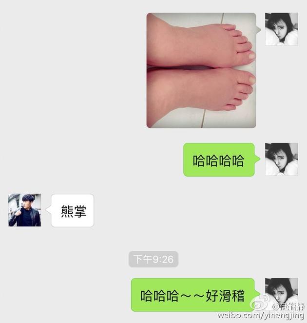 伊能靜臨產腳腫肚子過敏