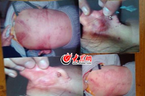 　山東藝術(shù)設(shè)計(jì)學(xué)院16歲女生宿舍內(nèi)被女同學(xué)暴打4小時(shí)。