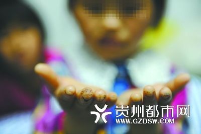 指尖被針扎得傷痕累累。