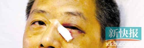 ■這起醫(yī)鬧事件，受傷的遠遠不只是熊旭明醫(yī)生的身體。