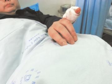 實(shí)習(xí)醫(yī)生陳洪左手的小拇指肌腱斷裂。