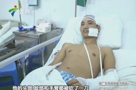 另一名傷者頭部、臉部和手臂都被砍了一刀。(視頻截圖)