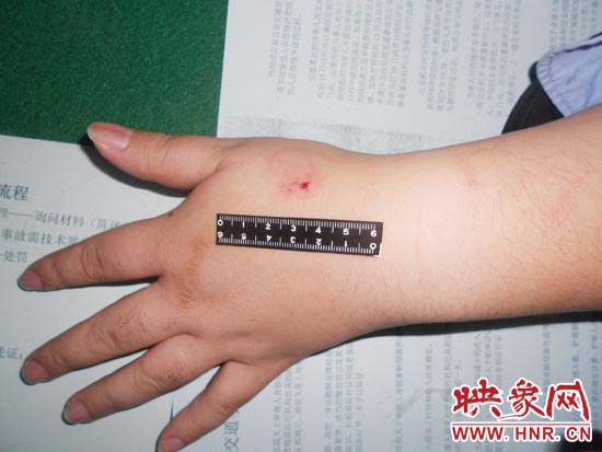 為幫助無證駕駛的朋友逃避處罰，新鄉(xiāng)的王某竟對執(zhí)勤民警大打出手，還將一名民警的手臂咬傷