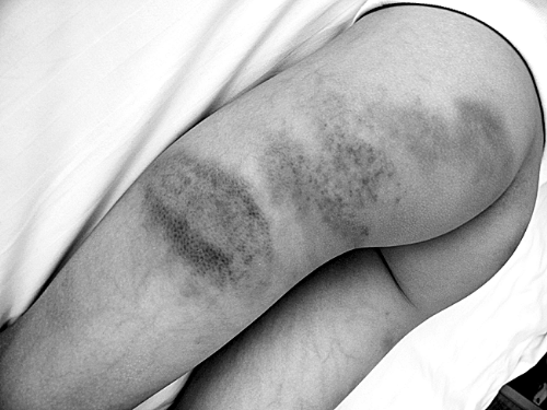 老師持掃帚打?qū)W生30分鐘 一個(gè)班20個(gè)同學(xué)被打過(guò)