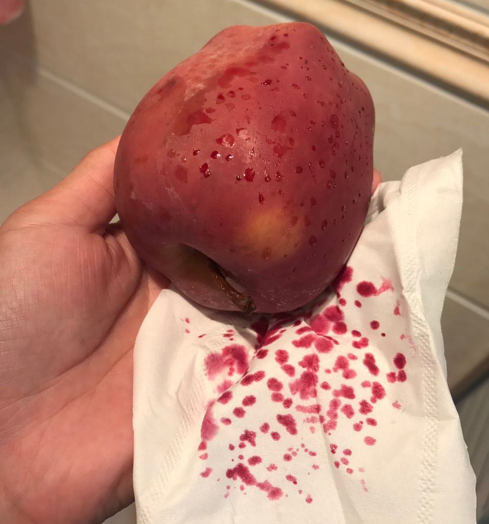 嚇懵！女子用熱水泡蘋果結(jié)果冒出血珠 咋回事？