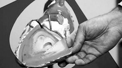 威廉斯領(lǐng)導(dǎo)的研究團(tuán)隊(duì)已經(jīng)利用人體脂肪干細(xì)胞，成功3D打印出心臟血管和心臟瓣膜，待一顆心臟的所有部件打