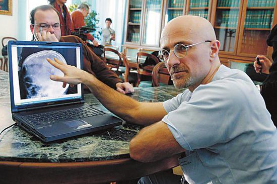 圖為卡納維洛醫(yī)生，不少人認(rèn)為他的想法非常瘋狂