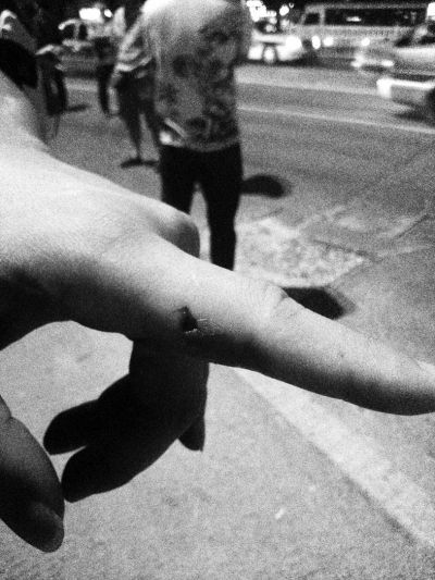 民警食指被咬傷。