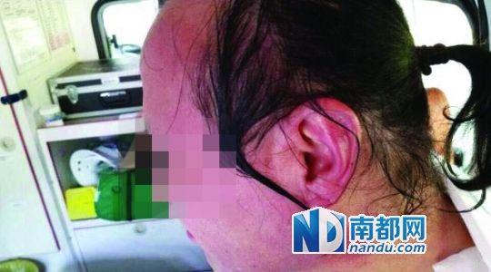 涉事教師遭熱水潑臉后的照片。