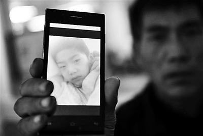 河北7歲男童誤把農(nóng)藥當牛奶喝致肺部全黑