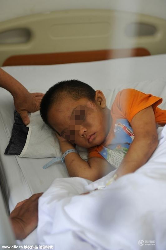 圖為全身傷痕累累的小進(jìn)。