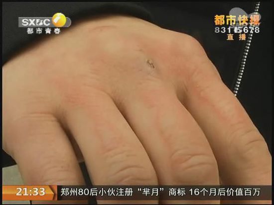 說到這足療拔罐，估計大伙都不陌生，但是想起4號晚上的拔罐的經(jīng)歷，呂先生現(xiàn)在想起來，還心有余悸。