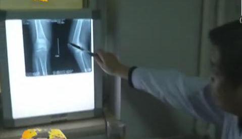 冷空氣來襲 如何預(yù)防老寒腿？