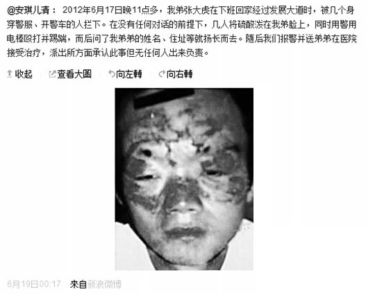 男子拒盤(pán)查遭潑辣椒水毀容 警方稱(chēng)或?qū)龠^(guò)敏